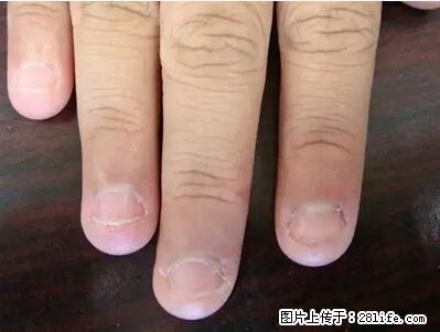 剪指甲、挖耳屎，这些日常小动作竟隐藏大危害！ - 湘潭生活资讯 - 湘潭28生活网 xiangtan.28life.net